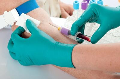 Možnost brezplačnega in anonimnega testiranja na okužbo z virusom hepatitisa B, C in HIV