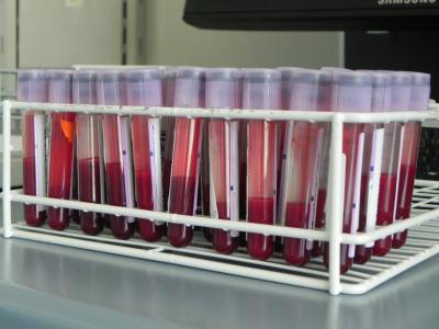 Dan odprtih vrat Oddelka za laboratorijsko medicino 2018