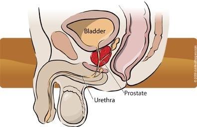 The prostate schematic